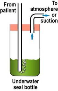 Underwater seal bottle. Image courtesy of medicine on line.com